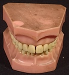 Dentadura; Material: Resina e Polímero; Ótimo Estado Conservada; Ideal para Decoração ou Colecionismo; Dimensões:8cm Comprimento;6cmn Altura;7cm Largura; Olhem as Fotos!