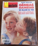 Revista Manchete nº 2296 (Abril/1996) - Gêmeas Siamesas Abigail e Brittany - Este exemplar original da revista Manchete, de 1996, apresenta uma das capas mais emocionantes e famosas da publicação, destacando as irmãs siamesas Abigail e Brittany Hensel com a manchete "Um Milagre da Vida".